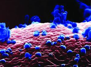 禽流感病毒攻击健康细胞照片曝光(附图)