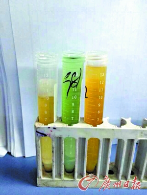 小石亚硝酸盐血液测试的结果呈绿色，正常的是黄色