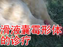 滑液囊霉形体的诊疗