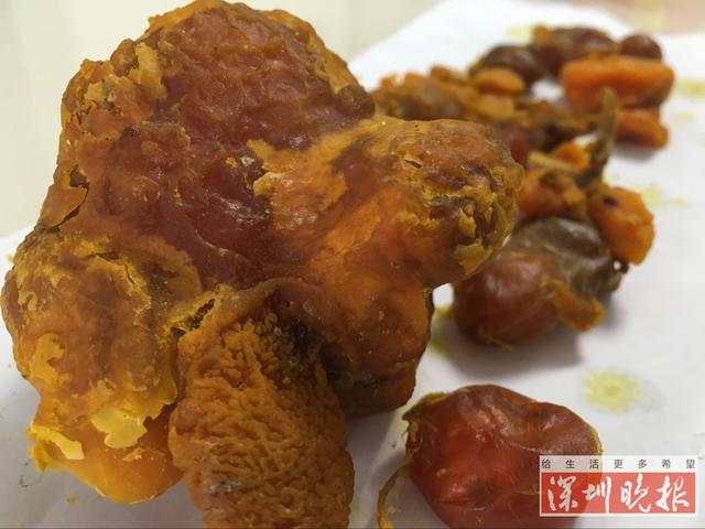 深圳市民杀鸡发现鸡宝?拍卖公司称值几百万(图)
