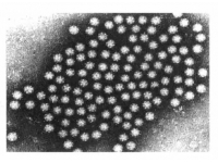 鸡星状病毒：从“白鸡”到“僵鸡”，这个隐形杀手你了解吗？