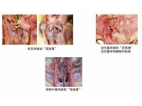 肾肿与花斑肾——综合鉴别诊断